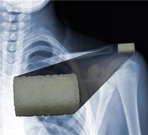 puebla-researchers-unveil-new-3d-printable-implant-material-that-facilitates-bone-regeneration-2