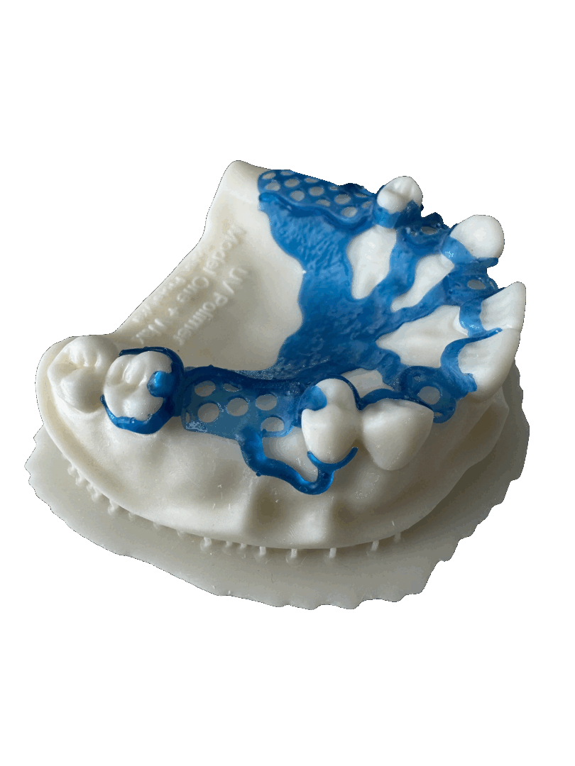Żywica Dental Cast na modelu zębów – protetyka